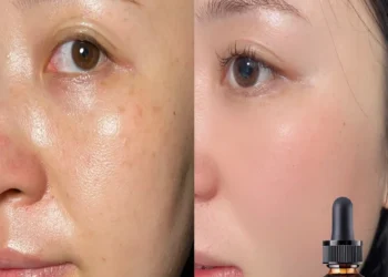 Top Alcohol-Free Facial Oil for Deep Hydration and Radiant Skin Results